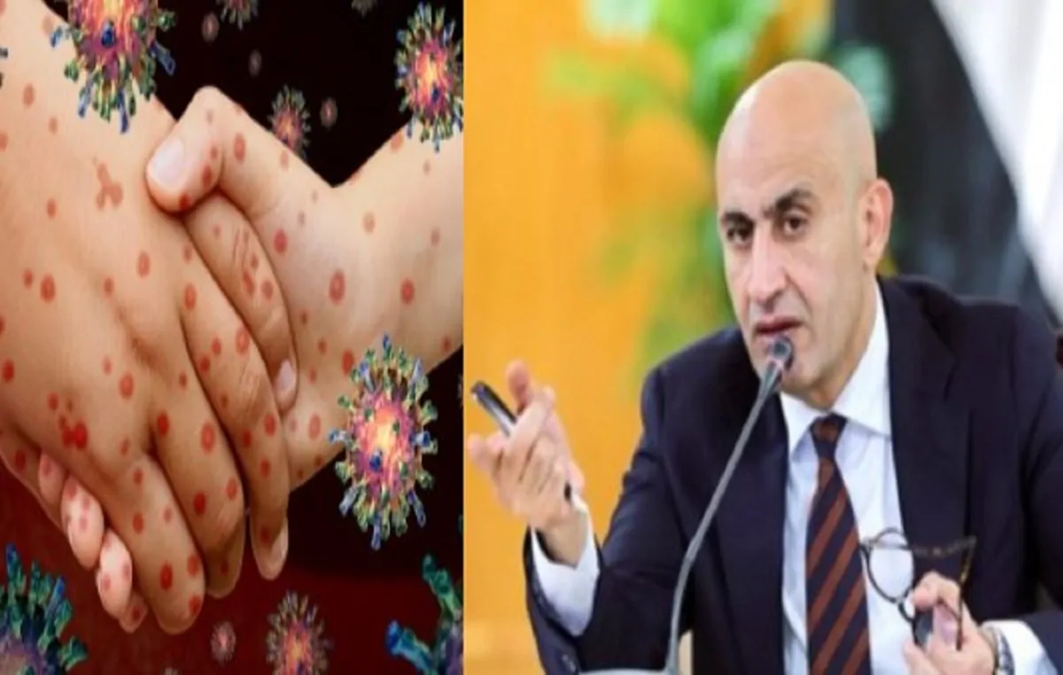 «تفاصيل ظهور فيروس ماربورج في المدارس: توضيح حاسم من تعليم البحيرة»