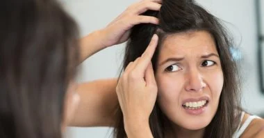 أسباب قشرة الشعر 5 خرافات شائعة يجب أن تتوقف عن تصديقها