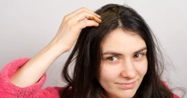 وداعًا لقشرة الرأس الدهنية وصفات طبيعية فعالة والقهوة في الصدارة