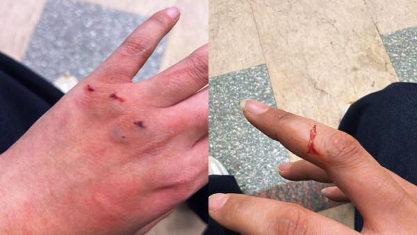 «حادثة مؤسفة في المقطم» فتاة تتهم ممرضة بمركز طبي شهير بالاعتداء عليها أثناء الكشف الطبي