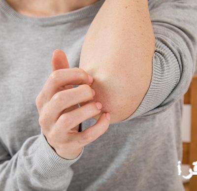 «استمتع بالدفء بلا حكة!» تجنب حكة الصوف المزعجة: دليلك الشامل لشتاء دافئ وبشرة صحية خالية من التهيج