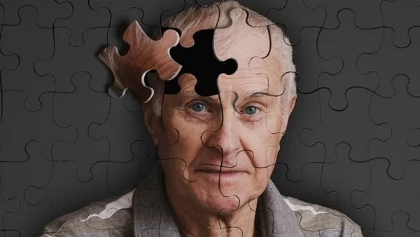 «صحتك العقلية على المحك: ما يجب أن تعرفه» دراسة متقدمة تكشف: السمنة تزيد بشكل مقلق من خطر الإصابة بالخرف - أقرأ 24 نيوز