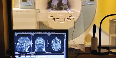 العلاج الصوتي غير الجراحي يبعث الأمل في مكافحة مرض ألزهايمر