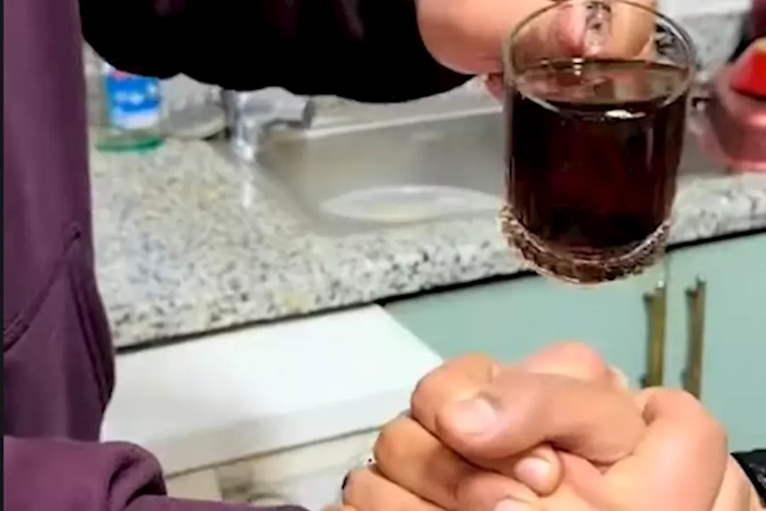 «تحدي الشاي المغلي: خطر يهدد حياة المراهقين بحروق وتشوهات»