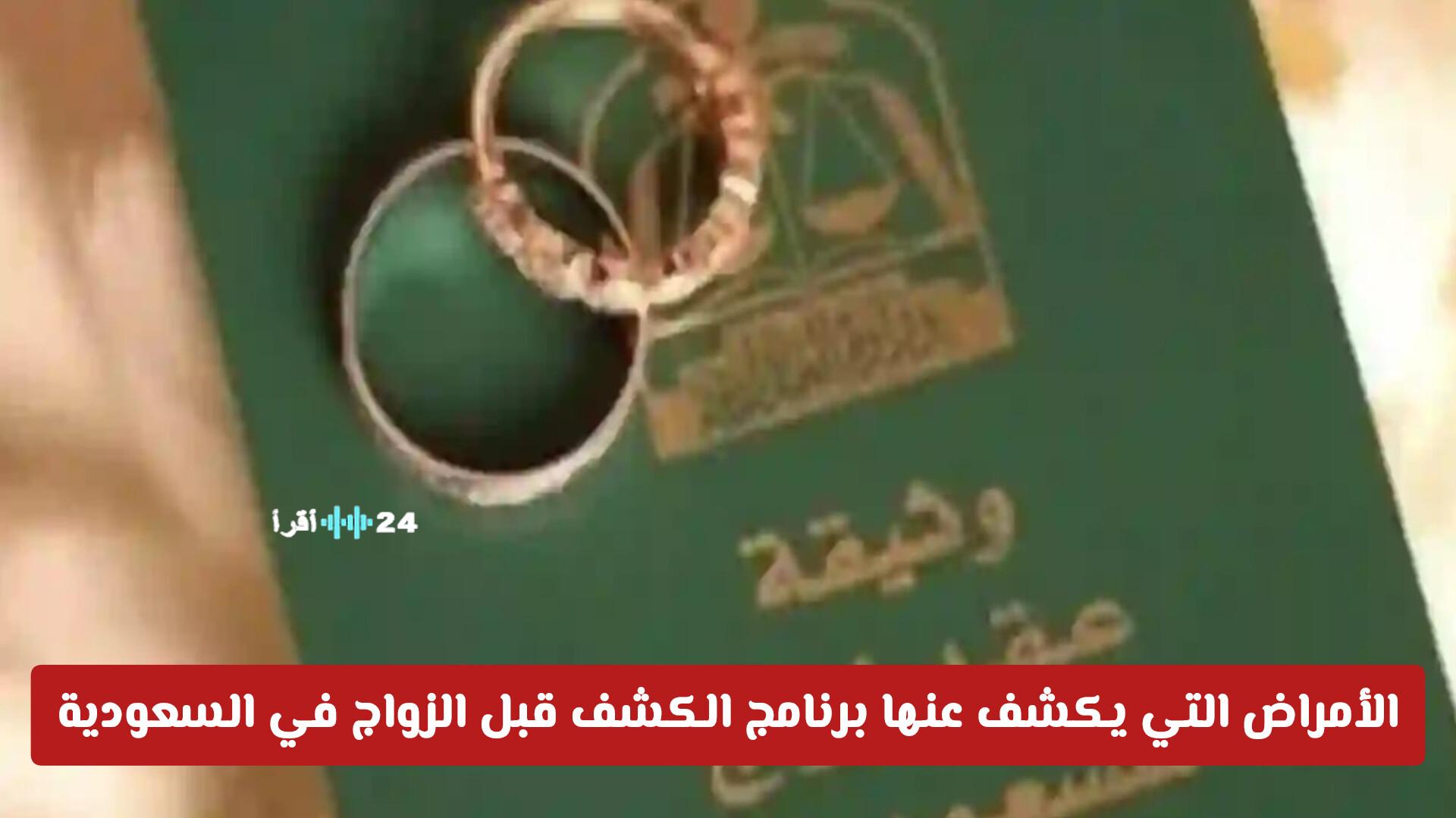 تعرّف على الأمراض التي يكشف عنها برنامج الكشف قبل الزواج في السعودية