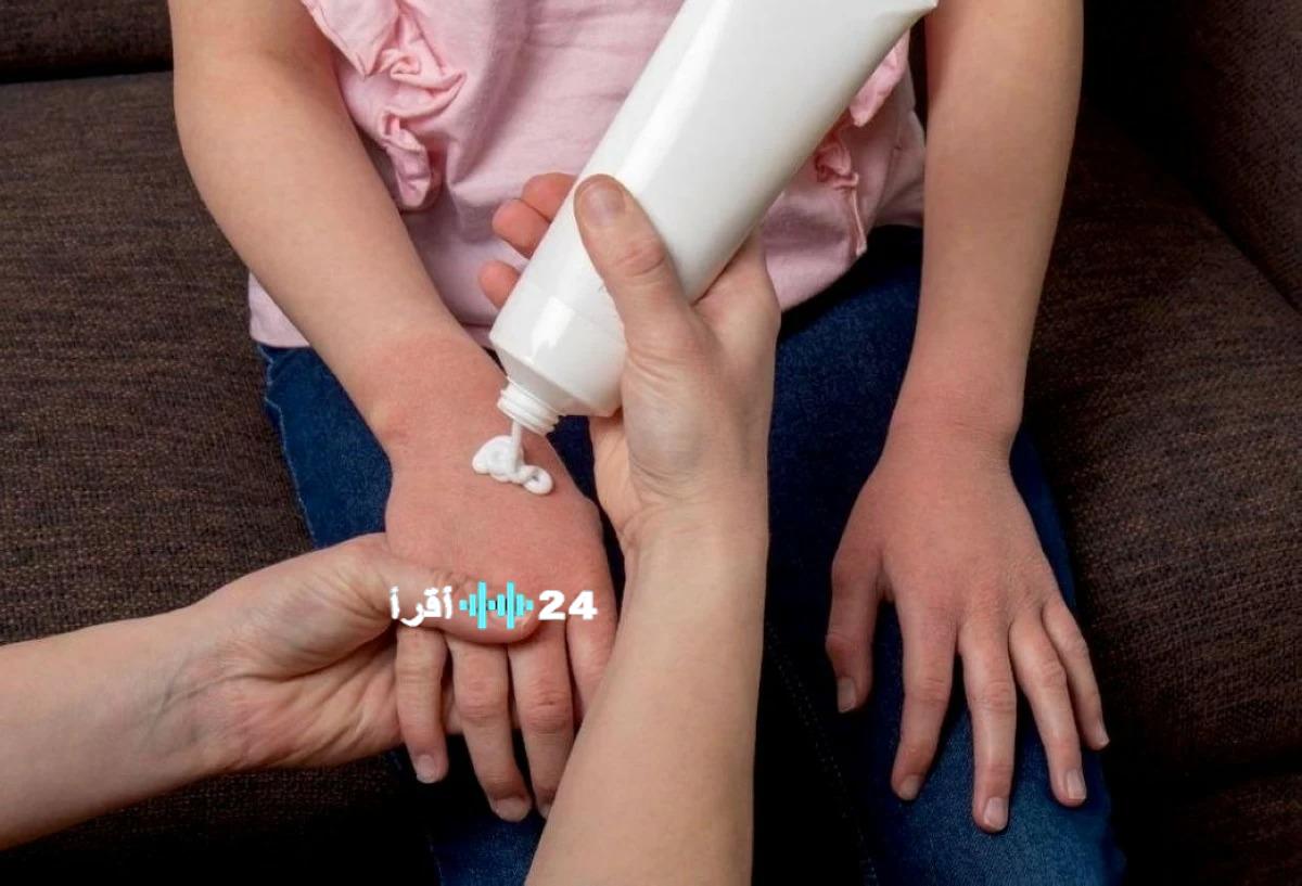 حماية الأطفال تواجه تحديات فوضى التجميل والكورتيزون خارج السيطرة