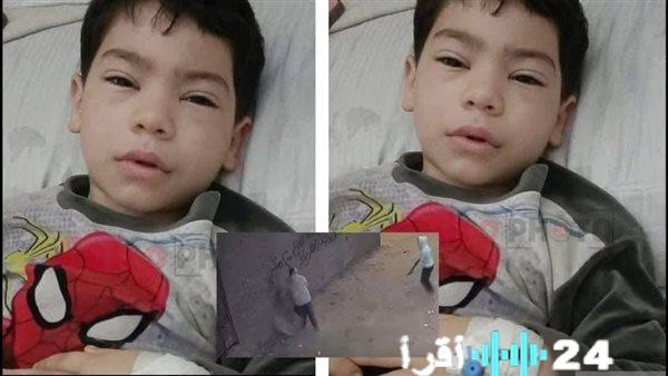 فريق طبي بمعهد ناصر ينقذ ساق طفل من البتر