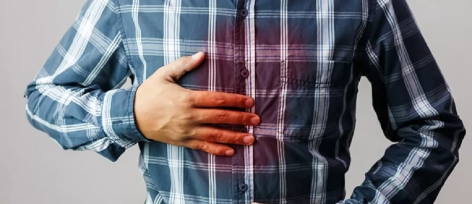 «وداعًا للحموضة!» رمضان بلا حرقة: استراتيجيات فعالة للتخفيف والعلاج خلال الصيام