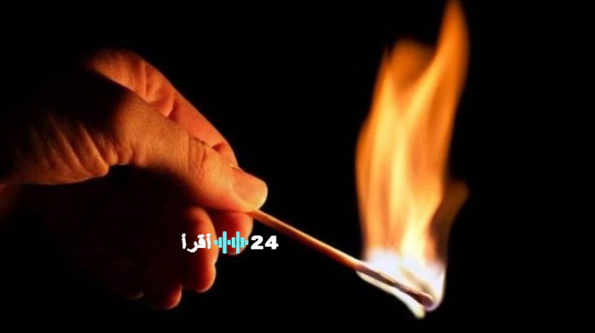 «شرارة غضب» مراهق يضرم النار بوجه جاره في عين شمس بسبب معاتبته على الضوضاء