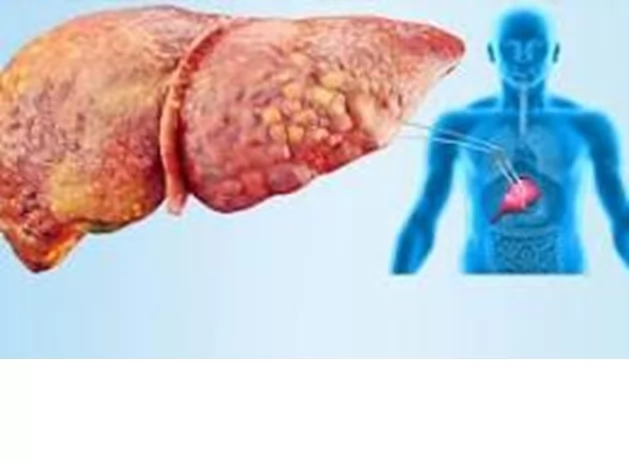 «تحذير هام يتكشف!» المحليات الصناعية: دراسات حديثة تربط بدائل السكر بتلف الكبد وتثير تساؤلات حول السلامة