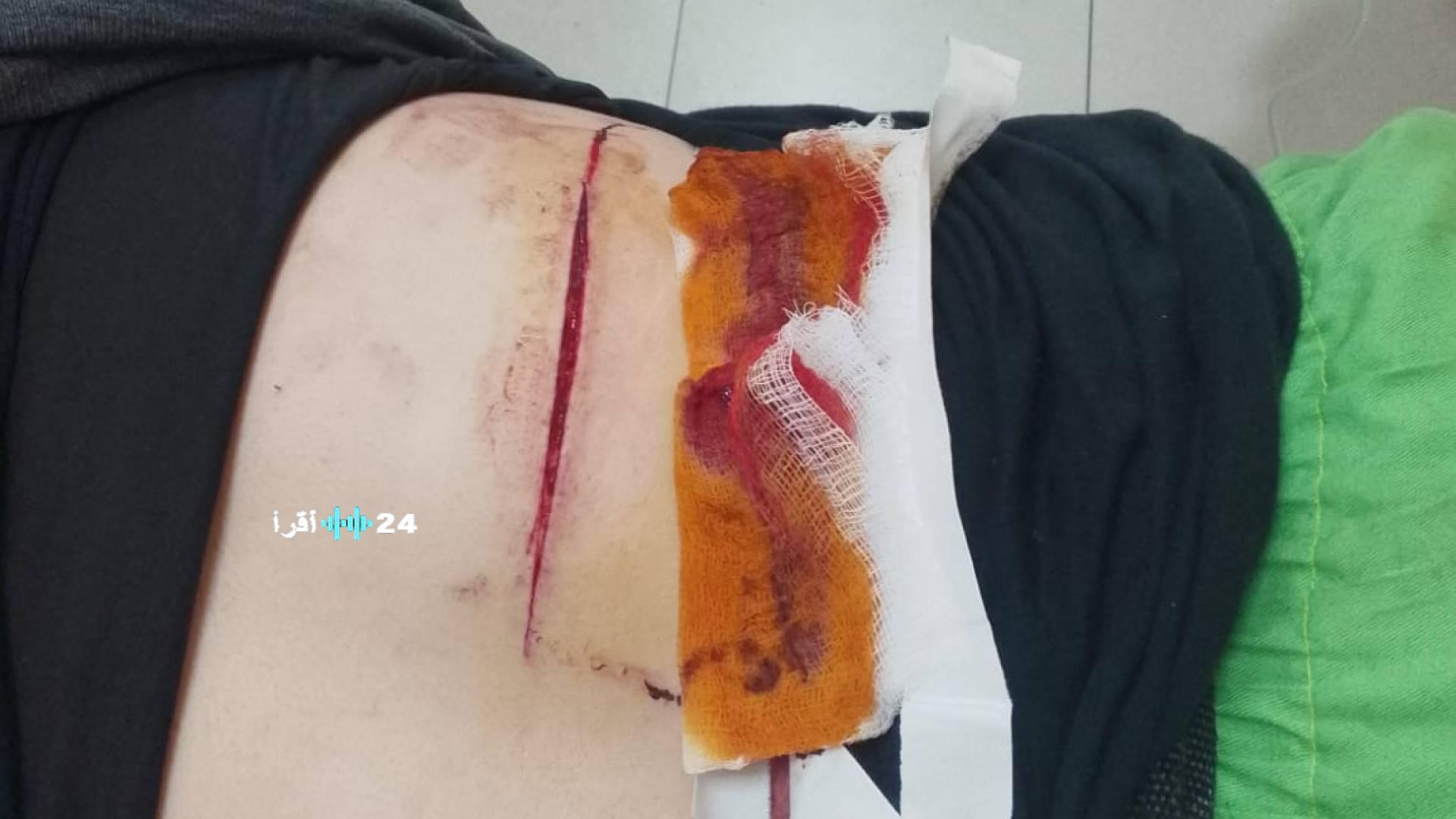 «عمل شاق وظلم غير مقبول» عامل وطن يتعرض للاعتداء أثناء تأدية واجبه في عمان