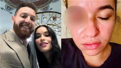 زوجة محمود حجازي تكشف عنفًا أسريًا وتتهمه بإهمال نفقة ابنه