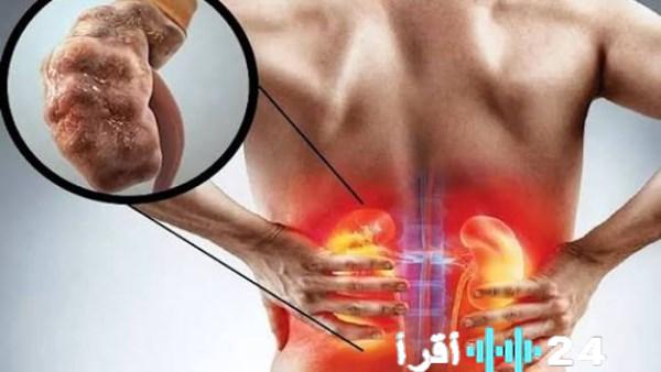انتبهوا خلال رمضان تجنبوا الأخطاء الشائعة عند شرب الماء أثناء الإفطار لضمان حماية الكلى